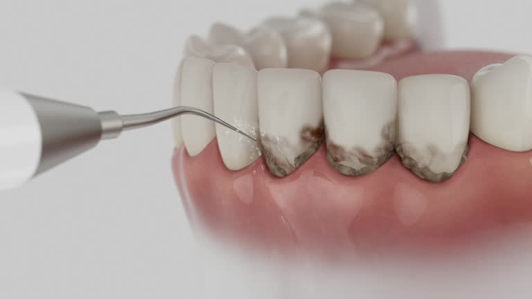 Reliable Emergency Dentist contractor in Burgin, KY by Smile Center Dentistry